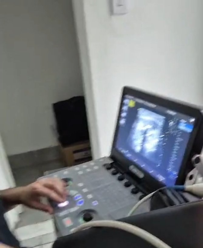 Exame de ultrassom em andamento